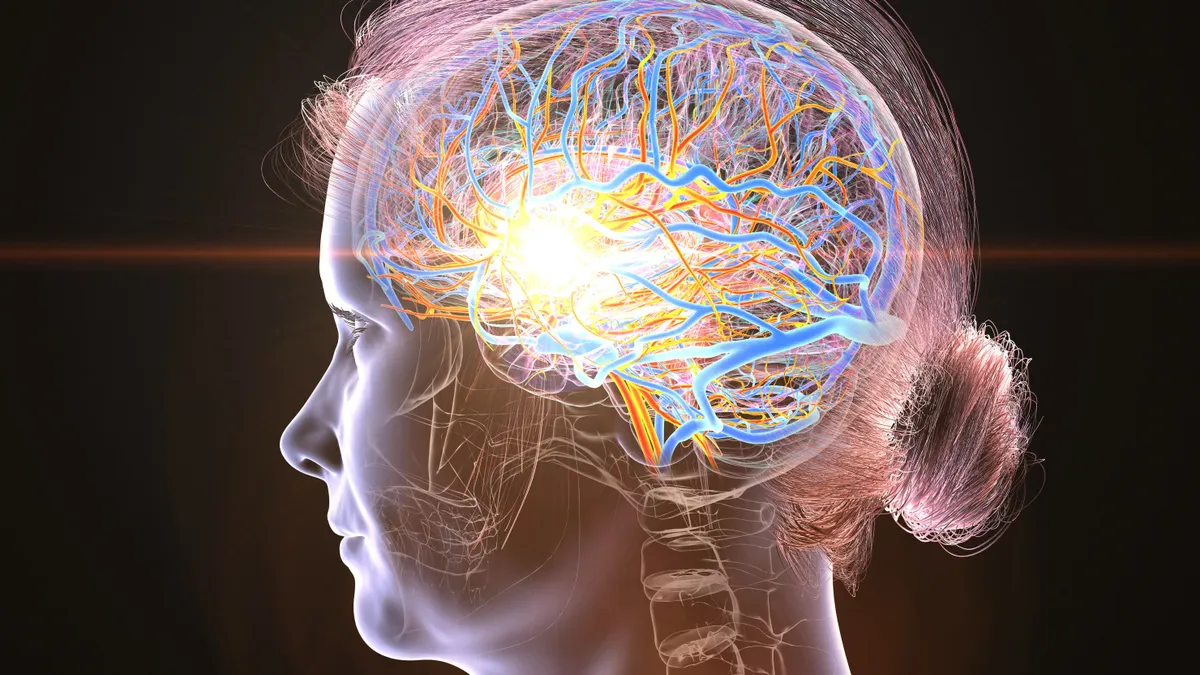 A mediterrán étrend hatékony lehet a stroke ellen.