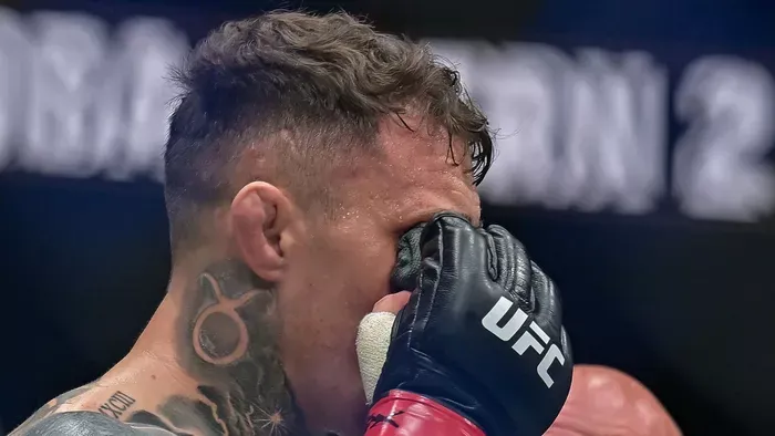 Hatalmas a baj: mindkét szemét meg kellett műteni az UFC világbajnokának – videó