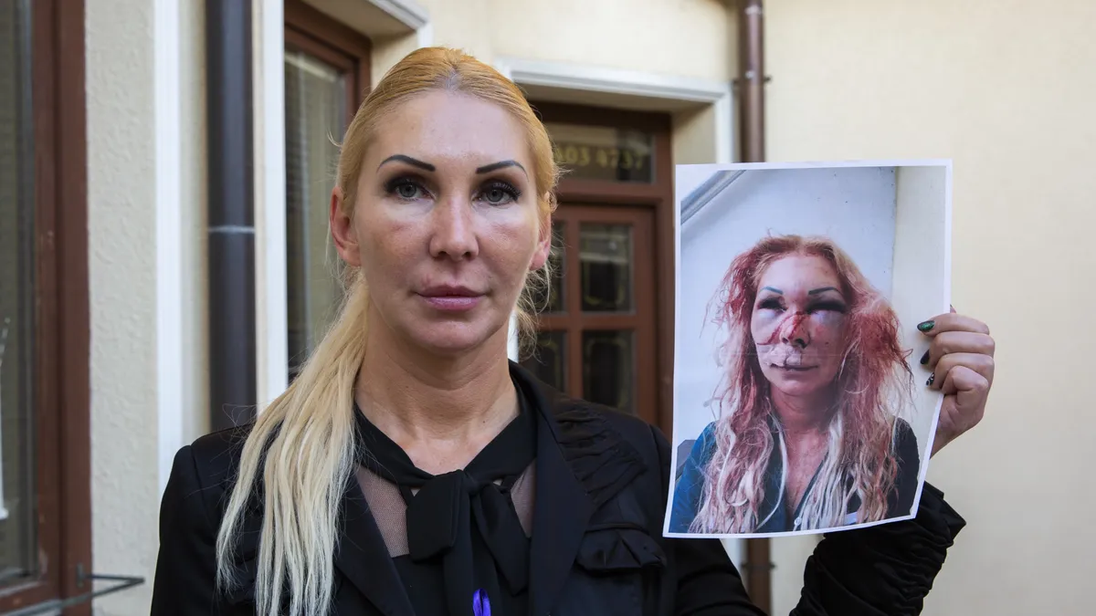 Orosz Bernadett évekkel korábbi fotóját mutatja