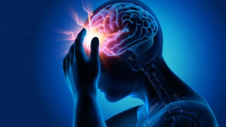 Stroke: 3 hétköznapi szokás, amely növelheti a kockázatot