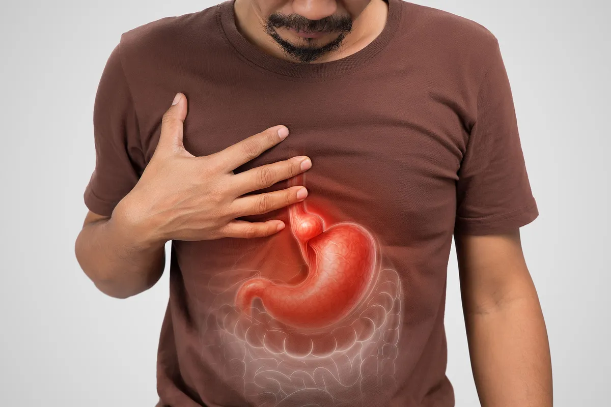 A Hiatal Hernia is illustrated with a line drawing showing the body’s internal symptom part of the stomach pushing through the diaphragm into the chest cavity. Stomach Ache. Stomach Pain