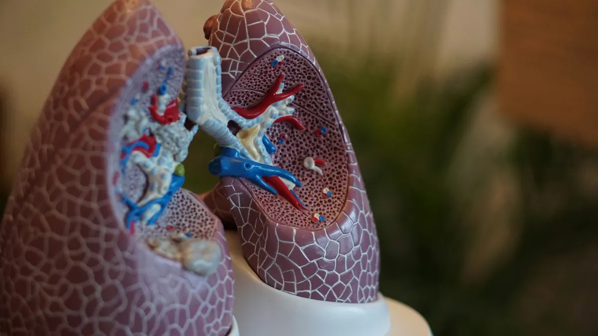 A plasztikus bronchitis nevű tüdőbetegség elzárhatja a légutakat - Képünk illusztráció Fotó: Unsplash