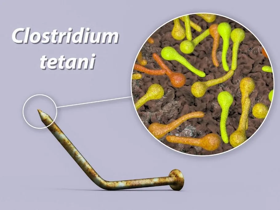 tetanusz Transmission of tetanus bacteria. Conceptual illustration showing an old rusty metal nail as a source of infection and a close-up view of Clostridium tetani bacteria, the cause of tetanus. (Photo by KATERYNA KON/SCIENCE PHOTO LIBRA / KKO / Science Photo Library via AFP)