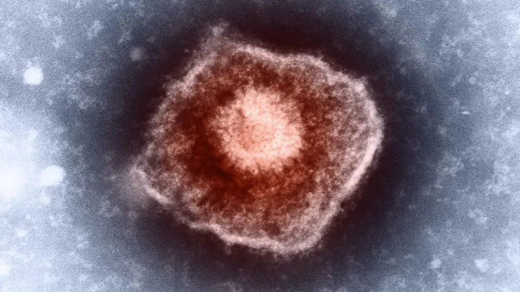 Egy norvég férfi a világ egyik legkülönlegesebb orvosi esetévé vált, miután egy úttörő transzplantáció után már nem mutatható ki a szervezetében a HIV-vírus