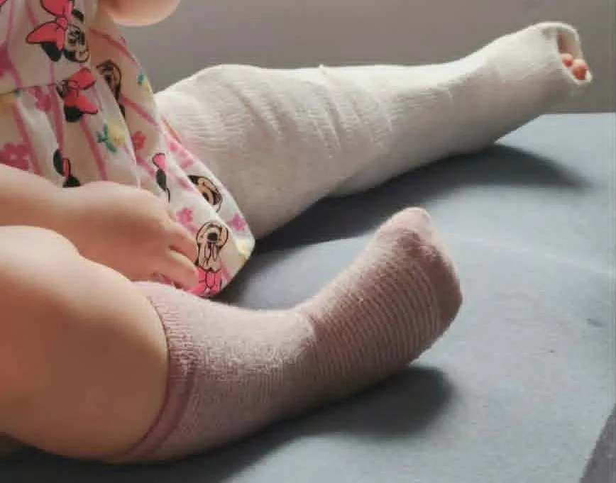 A biciklis gázolás nyomán a pécsi kislánynak eltört a sípcsontja