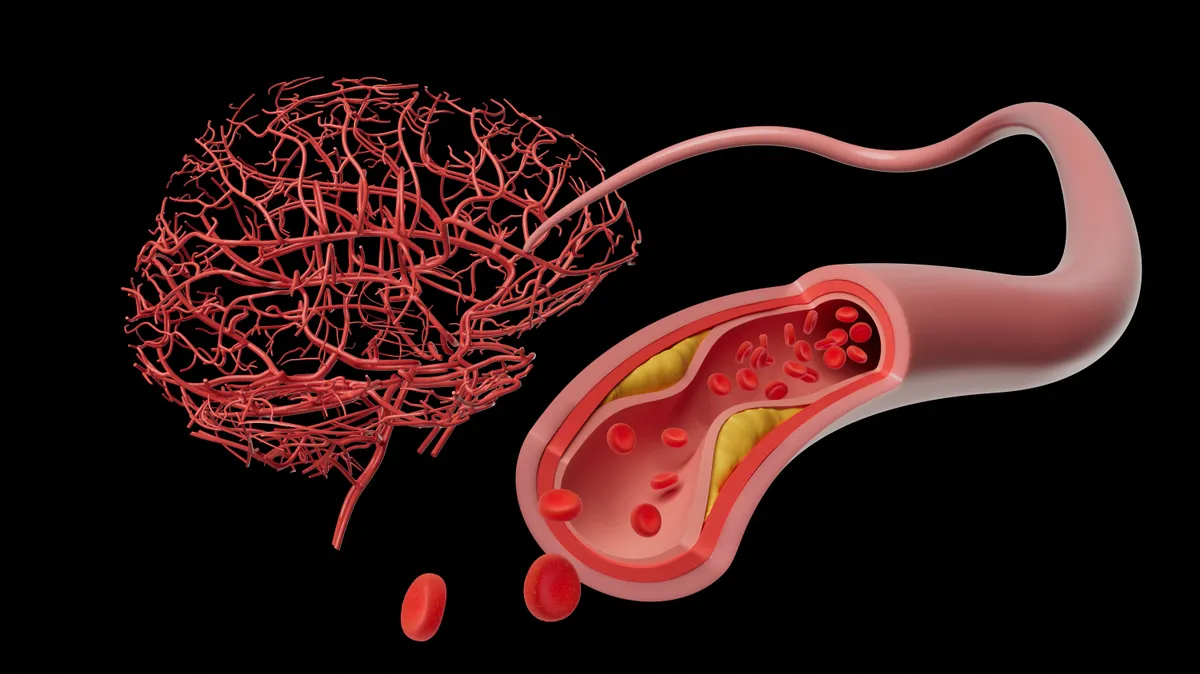 A magas Lipoprotein(a) szint a megszokott kezelések ellenére is folyamatos fenyegetést jelent a szervezetre