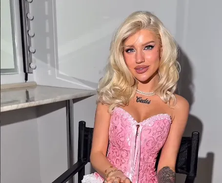 VV Merci mellműtétjéről beszélt egy TikTOk-videó keretében