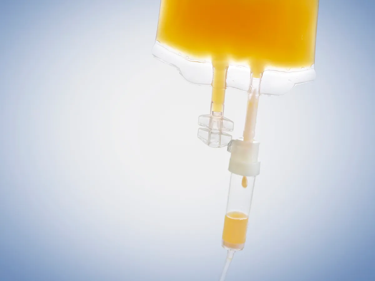 Az intravénásan beadott, nagy dózisú C-vitamin segítheti a rákbetegek túlélési esélyeit a hagyományos terápiák mellett