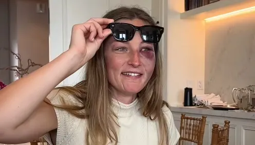 Nem fogja elhinni, mi találta el egy nő arcát