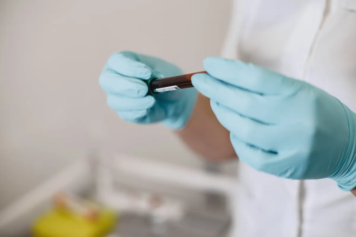 A normális koleszterinszint mögött is komoly, rejtett kockázat húzódhat meg