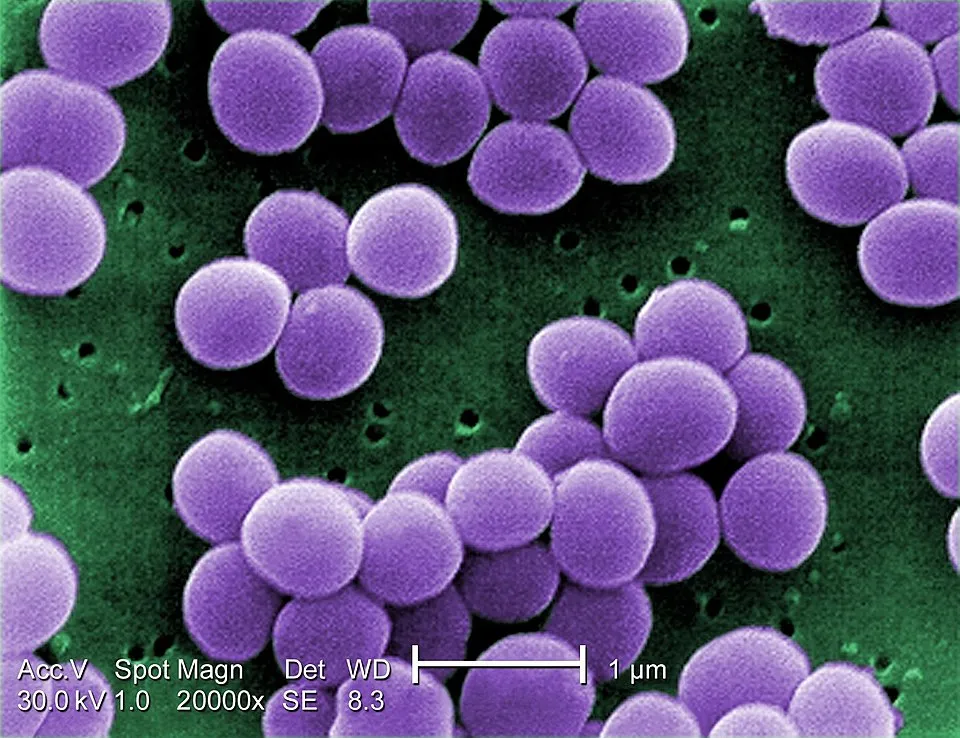 A Staphylococcus aureus egy Gram-pozitív baktérium a Staphylococcus nemzetségből