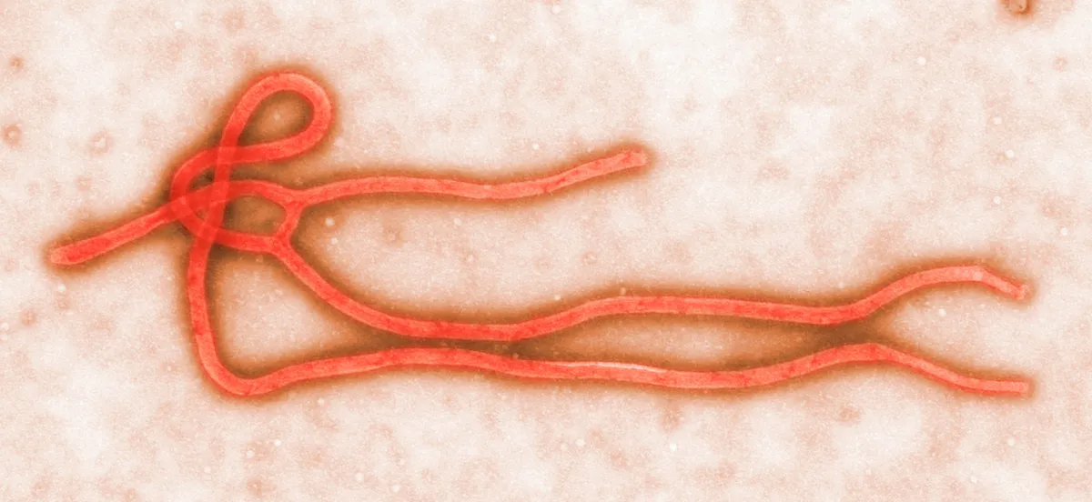 Transmission Electron micrograph of Ebola virus (Photo by Callista Images / Connect Images via AFP)