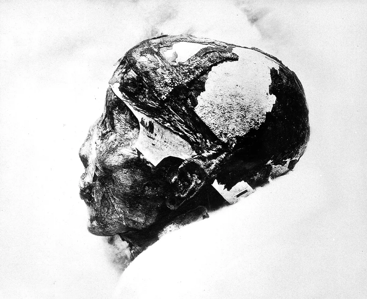 Tutankhamon mumifikál koponyája.