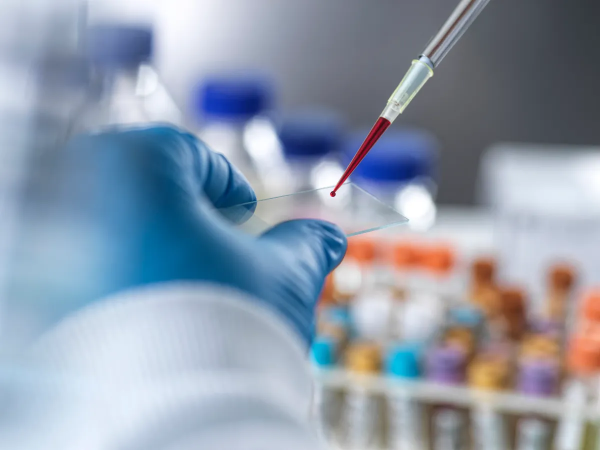 A fertőzés kezdetén az ebola és a hantavírus is produkálhat influenzaszerű tüneteket