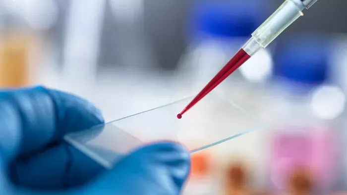 Aggasztó változást észleltek az emberi vérben a tudósok