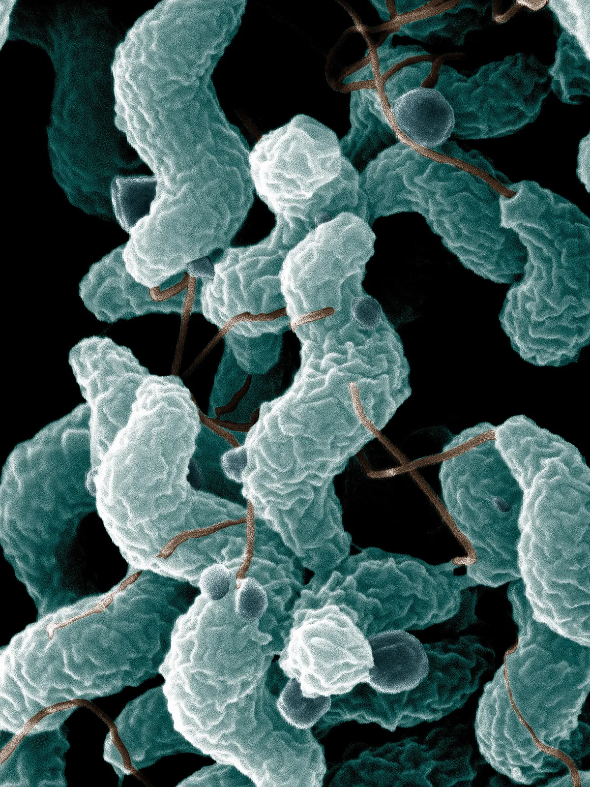 A Guillain-Barré-szindrómát kiváltó Campylobacter jejuni baktérium mikroszkóp alatt