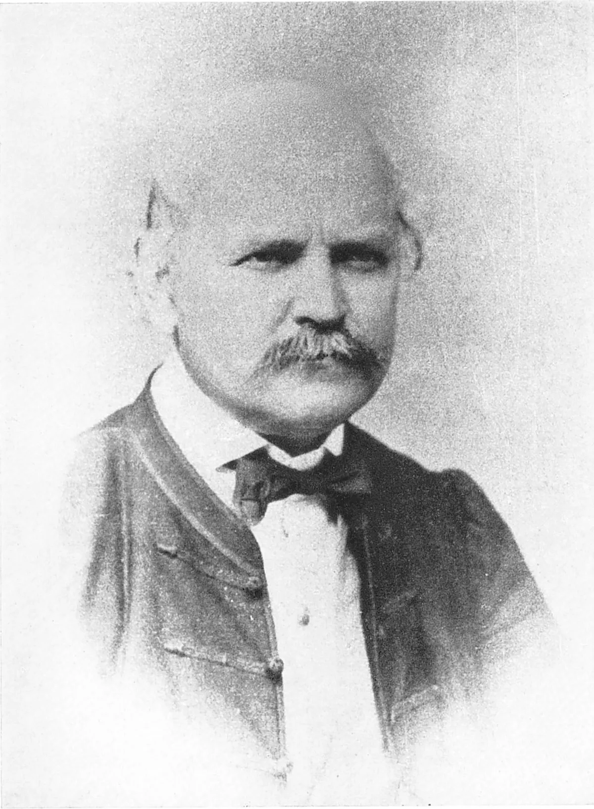 Semmelweis Ignác arcképe 1861-ből.