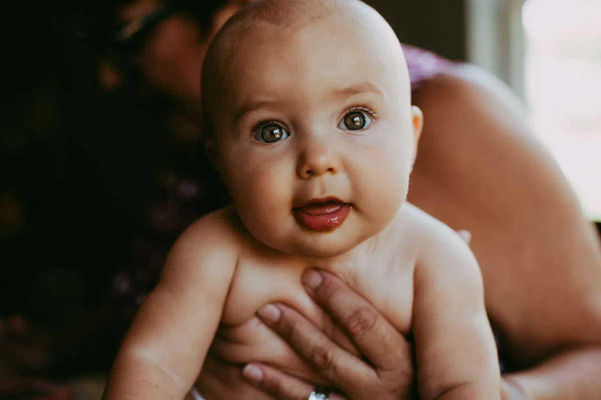 Az ausztrál Lulu állapotát egy ritka genetikai rendellenesség okozza (képünk illusztráció)
