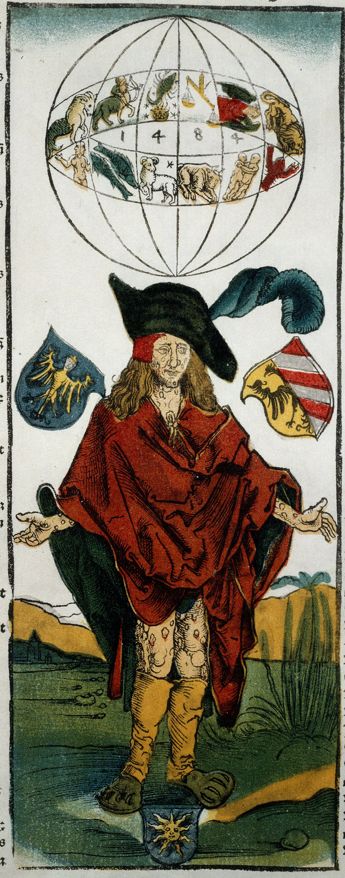 Szifiliszes férfi Albrecht Dürer festményén.