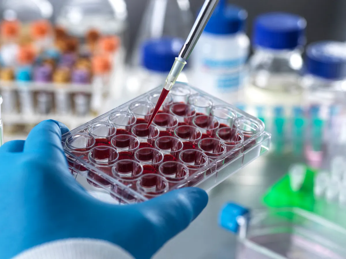 Alacsony tesztoszteronszint, hormonvizsgálat és daganatos kockázat kutatása laboratóriumi minták elemzésével