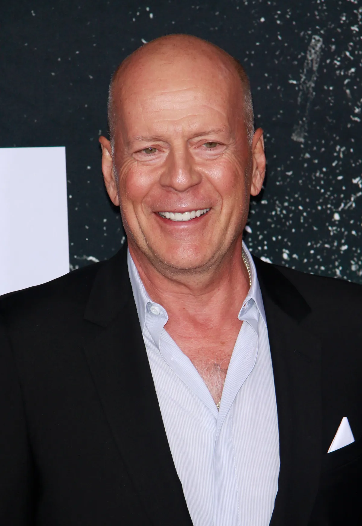 Bruce Willis súlyos betegséggel küzd