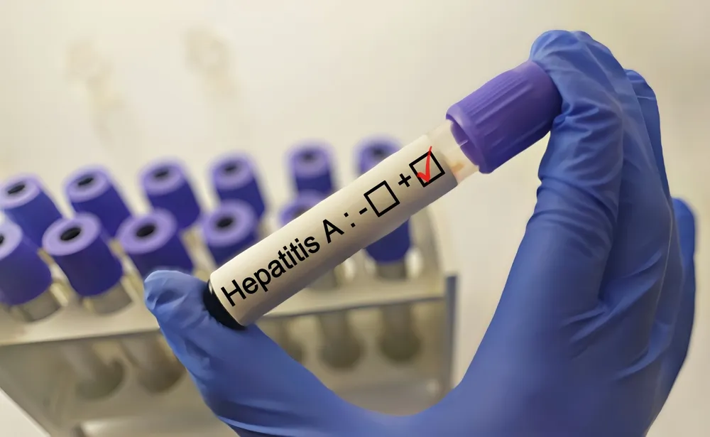 Kémcsőben hepatitis a vírus