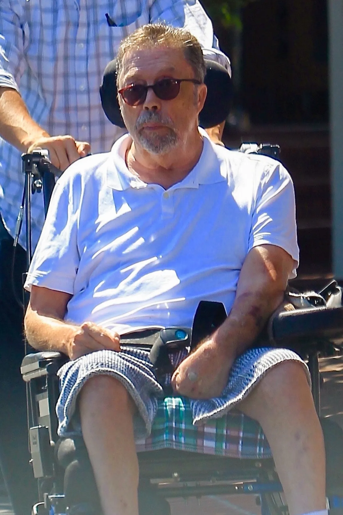 West Hollywood, CA  - *EXCLUSIVE* English actor Tim Curry looks frail in his wheelchair shopping with a mystery woman at Fred Segal in West Hollywood.Pictured: Tim CurryBACKGRID USA 3 AUGUST 2017 BYLINE MUST READ: Yellow Mamba / BACKGRIDUSA: +1 310 798 9111 / usasales@backgrid.comUK: +44 208 344 2007 / uksales@backgrid.com*UK Clients - Pictures Containing ChildrenPlease Pixelate Face Prior To Publication*  August   2017