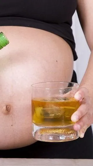 A magzati alkoholszindróma iszonyatos pusztítása