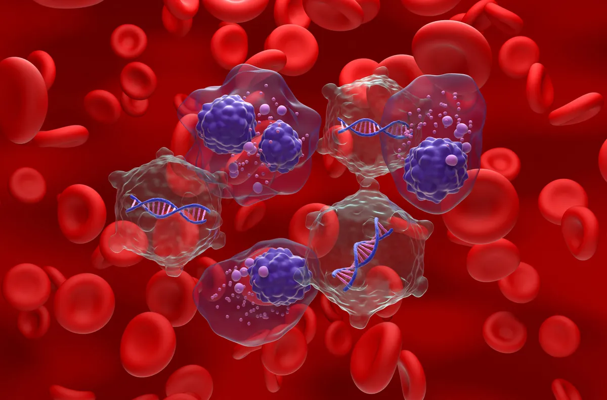 T-sejt-terápia, T-sejtek, daganatsejtek, immunterápia, szolid tumorok, rákkezelés, daganatellenes immunválasz