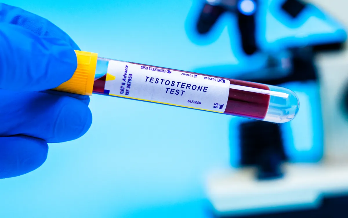 Zsigeri zsír, tesztoszteronszint, tesztoszteron-vérvizsgálat, hasi zsír, férfi hormonok, alacsony tesztoszteronszint